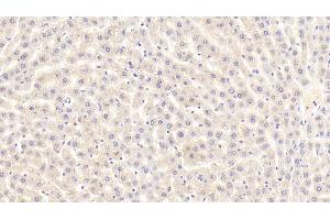 Detection of HMGCR in Rat Liver Tissue using Polyclonal Antibody to 3-Hydroxy-3-Methylglutaryl Coenzyme A Reductase (HMGCR)