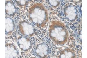 Detection of CRP in Human Rectum Tissue using Polyclonal Antibody to C Reactive Protein (CRP) (CRP anticorps  (AA 17-224))