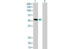 Western Blot analysis of RING1 expression in transfected 293T cell line by RING1 monoclonal antibody (M01), clone 3G6. (RING1 anticorps  (AA 81-170))
