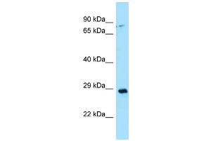 WB Suggested Anti-CA13 Antibody Titration: 1.