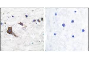 Immunohistochemistry analysis of paraffin-embedded human brain tissue, using ERAB Antibody. (HSD17B10 anticorps  (AA 111-160))