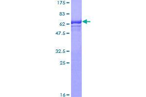 Image no. 1 for Mannose Phosphate Isomerase (MPI) (AA 1-423) protein (GST tag) (ABIN1311204)
