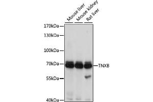 Western blot analysis of extracts of various cell lines, using TNXB antibody (ABIN3016209, ABIN3016210, ABIN3016211 and ABIN6219624) at 1:1000 dilution. (TNXB anticorps  (AA 444-673))
