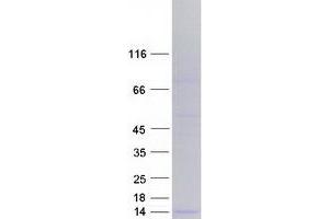 Validation with Western Blot