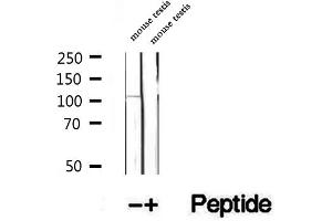 Western blot analysis of extracts of mouse testis tissue, using DIS3 antibody. (DIS3 anticorps  (Internal Region))