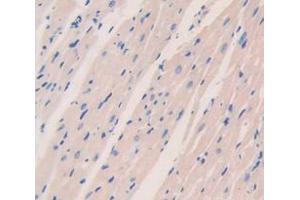 IHC-P analysis of Mouse Tissue, with DAB staining. (PDK1 anticorps  (AA 172-399))