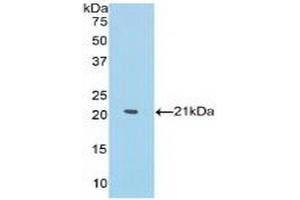 WB of Protein Standard: different control antibodies against Highly purified E. (MMP13 Kit CLIA)