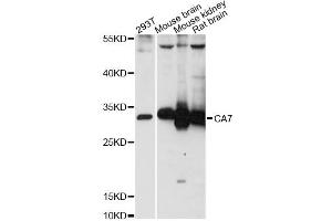 Western blot analysis of extracts of various cell lines, using CA7 antibody (ABIN6292752) at 1:3000 dilution.