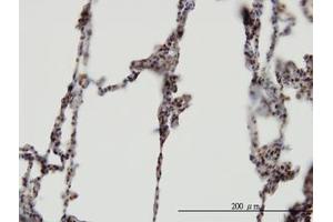 Image no. 1 for anti-XPA Binding Protein 2 (XAB2) (AA 1-856) antibody (ABIN599281) (XAB2 anticorps  (AA 1-856))