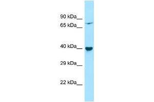 Host: Rabbit Target Name: PPM1L Sample Type: HepG2 Whole Cell lysates Antibody Dilution: 1. (PPM1L anticorps  (Middle Region))