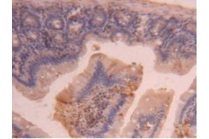 Detection of CPB2 in Mouse Intestine Tissue using Polyclonal Antibody to Carboxypeptidase B2 (CPB2)