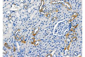 ABIN6264573 and ABIN6278624 at 1/100 staining Rat kidney tissue by IHC-P. (RAB35 anticorps  (Internal Region))