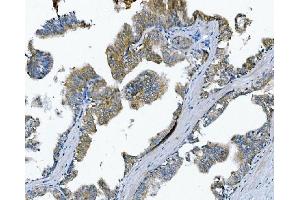 anti-Poliovirus Receptor (PVR) (AA 28-331) antibody