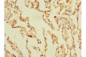 Immunohistochemistry of paraffin-embedded human lung tissue using ABIN7170179 at dilution of 1:100