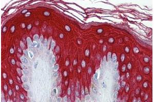 Human Skin: Formalin-Fixed, Paraffin-Embedded (FFPE)