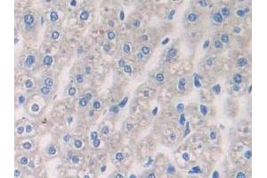 Detection of AHSG in Mouse Liver Tissue using Polyclonal Antibody to Alpha-2-Heremans Schmid Glycoprotein (AHSG)