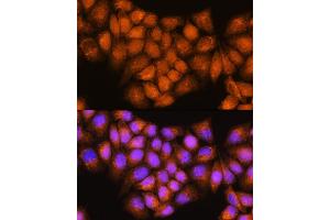 Immunofluorescence analysis of HeLa cells using  Rabbit pAb (ABIN7265658) at dilution of 1:100.