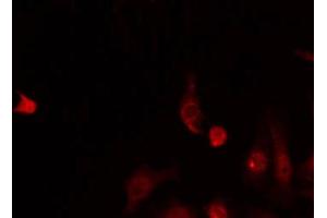 ABIN6268800 staining HeLa by IF/ICC. (BUB3 anticorps  (C-Term))