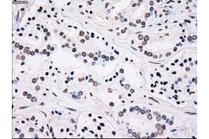 Image no. 6 for anti-Polo-Like Kinase 1 (PLK1) antibody (ABIN1500282)