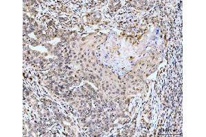 IHC analysis of MSK2/RSK-B/RPS6KA4 using anti-MSK2/RSK-B/RPS6KA4 antibody (ABIN7601238).