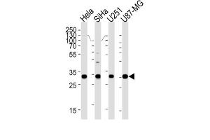 Western Blotting (WB) image for anti-Homeobox B2 (HOXB2) antibody (ABIN3004768) (HOXB2 anticorps)