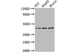 Western Blot Positive WB detected in: PC-3 whole cell lysate, HepG2 whole cell lysate, Mouse brain tissue All lanes: STAC antibody at 3 μg/mL Secondary Goat polyclonal to rabbit IgG at 1/50000 dilution Predicted band size: 45 kDa Observed band size: 45 kDa (STAC anticorps  (AA 1-119))
