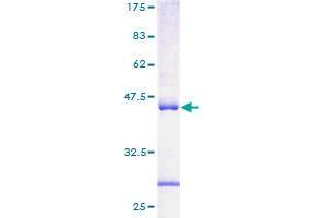 Image no. 1 for Acetyl-CoA Acetyltransferase 1 (ACAT1) (AA 16-162) protein (GST tag) (ABIN1305610)