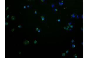 Immunofluorescence staining of MCF-7 cells with ABIN7139980 at 1:100, counter-stained with DAPI. (OR2M2 anticorps  (AA 259-273))