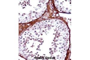 Immunohistochemistry (IHC) image for anti-T-Box 5 (TBX5) antibody (ABIN2998161) (T-Box 5 anticorps)