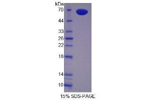SDS-PAGE analysis of Mouse Pregnancy Zone Protein. (PZP Protéine)