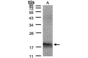 WB Image Sample(30 μg of whole cell lysate) A:293T 12% SDS PAGE antibody diluted at 1:1500 (MANF anticorps)