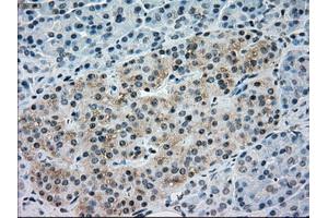 Immunohistochemical staining of paraffin-embedded Ovary tissue using anti-NRBP1mouse monoclonal antibody. (NRBP1 anticorps)