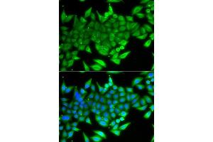 Immunofluorescence analysis of A549 cells using TTF2 antibody (ABIN5975177). (TTF2 anticorps)