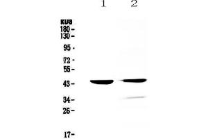 Western blot analysis of Cathepsin D using anti-Cathepsin D antibody . (Cathepsin D anticorps  (AA 161-358))