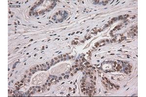 Immunohistochemical staining of paraffin-embedded breast tissue using anti-NOTCH1 mouse monoclonal antibody. (Notch1 anticorps  (AA 2300-2556))