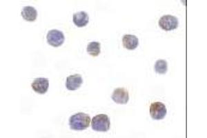 Immunocytochemical staining of DRAK2 in Jurkat cells with DRAK2 antibody at 10μg/ml. (DRAK2 anticorps  (AA 351-365))