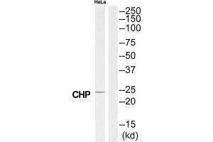 Western Blotting (WB) image for anti-Calcium Binding Protein P22 (CHP) (N-Term) antibody (ABIN1850961) (CHP anticorps  (N-Term))
