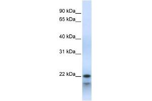 POLR3H antibody used at 1 ug/ml to detect target protein. (POLR3H anticorps  (Middle Region))
