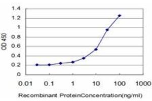 Detection limit for recombinant GST tagged AGER is approximately 0.