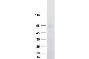 Validation with Western Blot