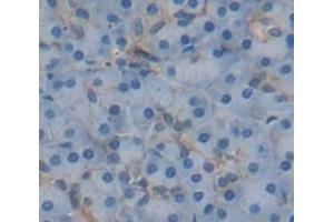 IHC-P analysis of Human Tissue, with DAB staining. (IL13RA2 anticorps  (AA 238-334))