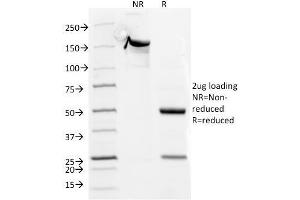SDS-PAGE Analysis Purified CD5 Mouse Monoclonal Antibody (CD5/54/F6). (CD5 anticorps)
