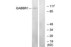 Western blot analysis of extracts from K562 cells, using GABBR1 Antibody. (GABBR1 anticorps  (AA 891-940))
