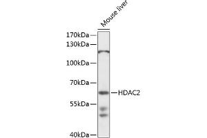 Western blot analysis of extracts of mouse liver, using HD antibody  at 1:1000 dilution. (HDAC2 anticorps  (AA 429-488))