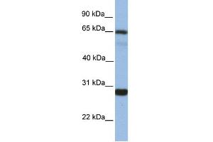WB Suggested Anti-MED4 Antibody Titration:  1 ug/ml  Positive Control:  Fetal liver cell lysate (MED4 anticorps  (Middle Region))