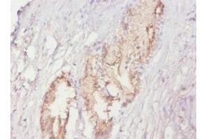 Immunohistochemistry of paraffin-embedded human prostate tissue using ABIN7164895 at dilution of 1:20 (ACPP anticorps  (AA 38-386))
