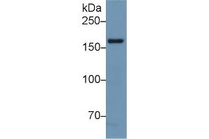Detection of NOS1 in Mouse Cerebrum lysate using Polyclonal Antibody to Nitric Oxide Synthase 1, Neuronal (NOS1) (NOS1 anticorps  (AA 9-136))