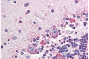Human Brain, Cerebellum (formalin-fixed, paraffin-embedded) stained with ALPP antibody ABIN296659 at 10 ug/ml followed by biotinylated anti-mouse IgG secondary antibody ABIN481714, alkaline phosphatase-streptavidin and chromogen. (PLAP anticorps)