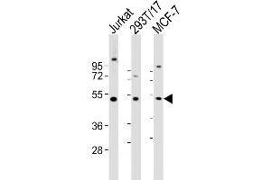 Western Blot at 1:2000 dilution Lane 1: Jurkat whole cell lysates Lane 2: 293T/17 whole cell lysates Lane 3: MCF-7 whole cell lysates Lysates/proteins at 20 ug per lane.