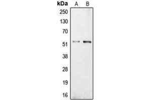 Western blot analysis of Carboxypeptidase E expression in NIH3T3 (A), PC12 (B) whole cell lysates. (CPE anticorps  (Center))